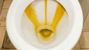 Cara menghilangkan air toilet kuning